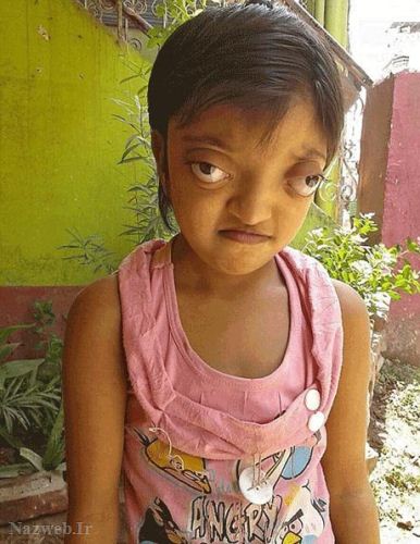 دختری با ترسناک و عجیب ترین چشم ها (عکس)
